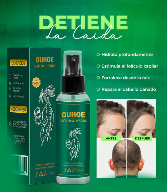 OUHOE -NO  MAS CAIDA DE CABELLO,CRECIMIENTO DE PELO